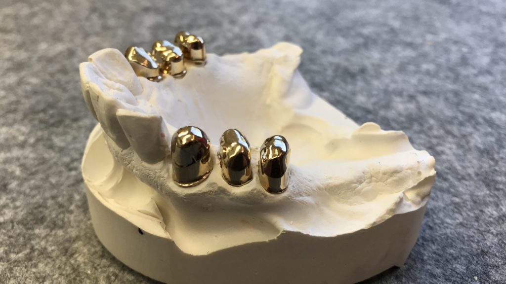 Ador Dental GmbH - Dental und Zahntechnikhandel in Hilden und Umgebung