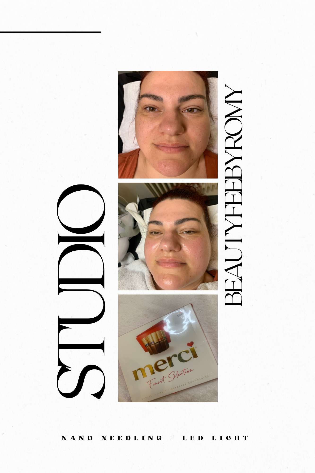 Beautyfeebyromy